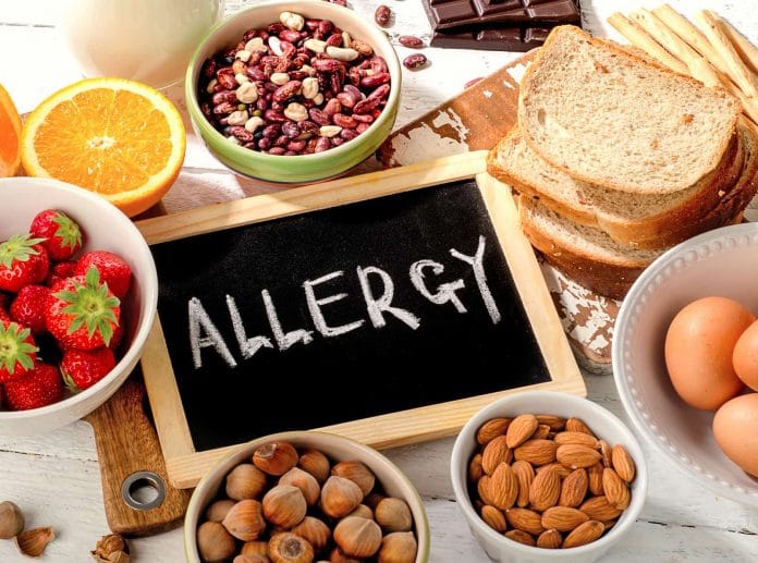 Food-Alergy Food Allergy Test