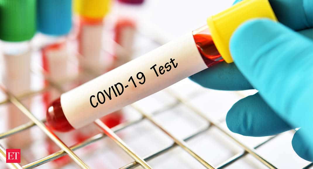 Covid -19 Test